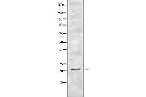 Western blot analysis of IFNA2 expression in HEK293 cells ,The lane on the left is treated with the antigen-specific peptide. (IFNA2 Antikörper  (N-Term))