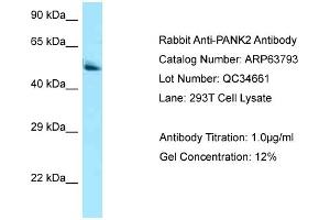 Western Blotting (WB) image for anti-Pantothenate Kinase 2 (PANK2) (C-Term) antibody (ABIN2789627)