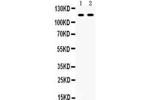Anti- CD44 Picoband antibody, Western blotting All lanes: Anti CD44  at 0. (CD44 Antikörper  (N-Term))