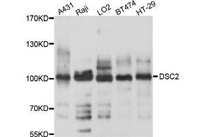 Western blot analysis of extracts of various cell lines, using DSC2 antibody (ABIN4903516) at 1:1000 dilution. (Desmocollin 2 Antikörper)