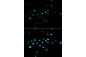 Immunofluorescence analysis of A549 cell using TRIM63 antibody. (TRIM63 Antikörper)