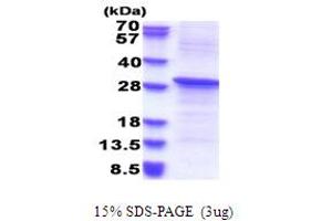 SDS-PAGE (SDS) image for REV1, Polymerase (DNA Directed) (REV1) (AA 51-256) protein (His tag) (ABIN5853688) (REV1 Protein (AA 51-256) (His tag))