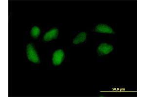 Immunofluorescence (IF) image for anti-Ribulose-5-Phosphate-3-Epimerase (RPE) (AA 1-228) antibody (ABIN519847)