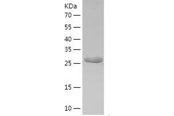 ACLY Protein (AA 4-265) (His tag)