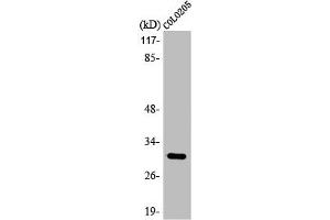 Western Blot analysis of HuvEc cells using ABHD11 Polyclonal Antibody (ABHD11 Antikörper  (Internal Region))