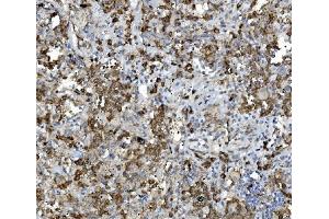 IHC analysis of PDIA5 using anti-PDIA5 antibody (ABIN7601801). (PDIA5 Antikörper  (AA 46-481))