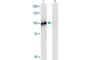 Western Blot analysis of NCAPH expression in transfected 293T cell line by NCAPH monoclonal antibody (M01), clone 1C9. (NCAPH Antikörper  (AA 645-741))