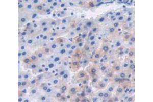 DAB staining on fromalin fixed paraffin- embedded Kidney tissue) (MT1 Antikörper  (AA 1-61))