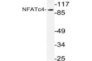 Western blot (WB) analysis of NFATc4 antibody in extracts from 293 cells. (NFATC4 Antikörper)