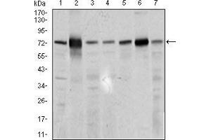 Western blot analysis using SLC27A5 mouse mAb against 3T3L1 (1), HepG2 (2), U937 (3), Raji (4), COS7 (5), NIH3T3 (6), and PC-3 (7) cell lysate. (SLC27A5 Antikörper  (AA 508-570))