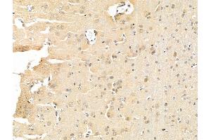 ABIN6261783 and ABIN6268901 at 1/100 staining Rat brain tissue by IHC-P.
