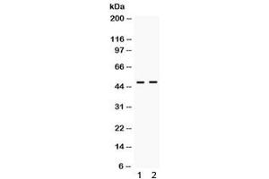 Western blot testing of human 1) HeLa and 2) A549 cell lysate with ING1 antibody. (ING1 Antikörper)