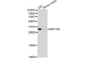 Western blot analysis of extracts of various cell lines, using RNF166 antibody (ABIN4905019) at 1:1000 dilution. (RNF166 Antikörper)