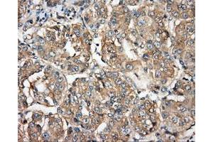 Image no. 4 for anti-Bruton Agammaglobulinemia tyrosine Kinase (BTK) antibody (ABIN1496974) (BTK Antikörper)