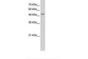 Image no. 2 for anti-serine/threonine Kinase 11 (STK11) (AA 71-120) antibody (ABIN203483) (LKB1 Antikörper  (AA 71-120))