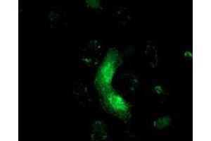 Anti-MRAS mouse monoclonal antibody (ABIN2454547) immunofluorescent staining of COS7 cells transiently transfected by pCMV6-ENTRY MRAS (RC212259). (MRAS Antikörper)