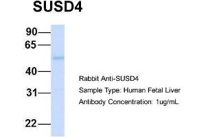 Host:  Rabbit  Target Name:  SUSD4  Sample Type:  Human Fetal Liver  Antibody Dilution:  1. (SUSD4 Antikörper  (N-Term))