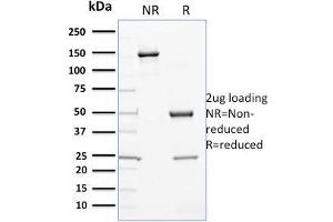 SDS-PAGE Analysis Purified Cytochrome P450 1A1/1A2 Mouse Monoclonal Antibody (P6). (CYP3A1 Antikörper)