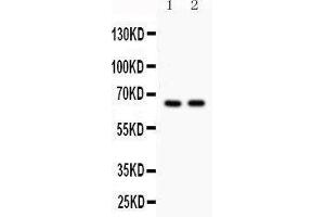 Anti- Cdc25B Picoband antibody, Western blotting All lanes: Anti Cdc25B  at 0. (CDC25B Antikörper  (AA 119-248))