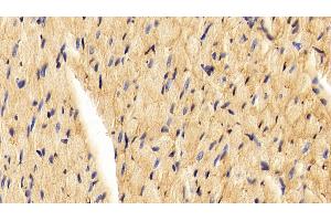 Detection of CAV1 in Rat Cardiac Muscle Tissue using Polyclonal Antibody to Caveolin 1 (CAV1) (Caveolin-1 Antikörper  (AA 2-105))