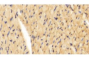 Detection of CAV1 in Rat Cardiac Muscle Tissue using Polyclonal Antibody to Caveolin 1 (CAV1)