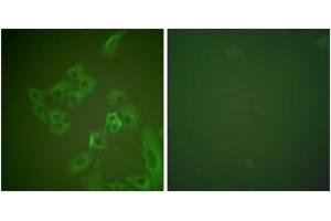 Immunofluorescence analysis of A549 cells, using Synuclein beta Antibody.