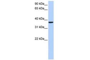 Image no. 1 for anti-High Mobility Group 20B (HMG20B) (AA 201-250) antibody (ABIN6742602) (HMG20B Antikörper  (AA 201-250))