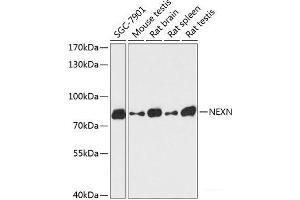 Western blot analysis of extracts of various cell lines using NEXN Polyclonal Antibody at dilution of 1:3000. (NEXN Antikörper)