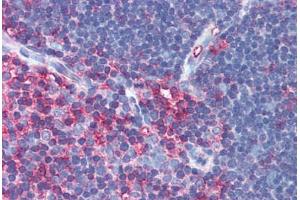 Anti-MSN / Moesin antibody IHC of human thymus. (Moesin Antikörper)