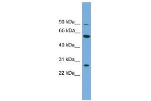 IMPDH2 antibody used at 1 ug/ml to detect target protein. (IMPDH2 Antikörper)