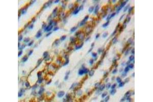 Used in DAB staining on fromalin fixed paraffin-embedded Kidney tissue