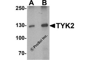 Western Blotting (WB) image for anti-Tyrosine Kinase 2 (TYK2) (N-Term) antibody (ABIN1077422) (TYK2 Antikörper  (N-Term))