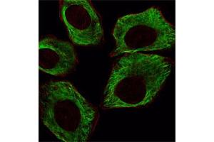 Immunofluorescent staining of A549 cell reacted with TUBB monoclonal antibody  at 1:25 dilution. (TUBB Antikörper)