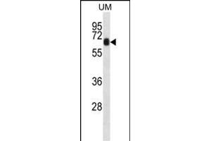 CCD Antibody (N-term) (ABIN657286 and ABIN2846373) western blot analysis in uterus tumor cell line lysates (35 μg/lane). (CCDC120 Antikörper  (N-Term))
