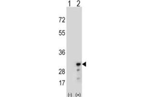 Western Blotting (WB) image for anti-Peroxiredoxin 3 (PRDX3) antibody (ABIN3001722) (Peroxiredoxin 3 Antikörper)