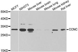 Western blot analysis of extracts of various cell lines, using CCNC antibody. (Cyclin C Antikörper)