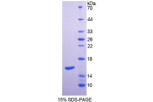 SDS-PAGE analysis of Mouse SPTLC2 Protein. (SPTLC2 Protein)