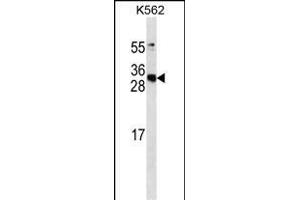 CS antibody ABIN658915 western blot analysis in K562 cell line lysates (35 μg/lane).
