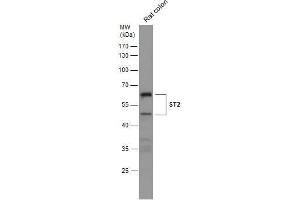 WB Image Rat tissue extract (50 μg) was separated by 10% SDS-PAGE, and the membrane was blotted with ST2 antibody [N1C1] , diluted at 1:500. (IL1RL1 Antikörper)