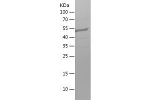 Western Blotting (WB) image for Adaptor-Related Protein Complex 2, alpha 1 Subunit (AP2A1) (AA 601-747) protein (His-IF2DI Tag) (ABIN7282635) (alpha Adaptin Protein (AA 601-747) (His-IF2DI Tag))