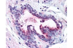 Image no. 1 for anti-Programmed Cell Death 4 (PDCD4) (pSer457), (Ser457) antibody (ABIN401369) (PDCD4 Antikörper  (pSer457, Ser457))