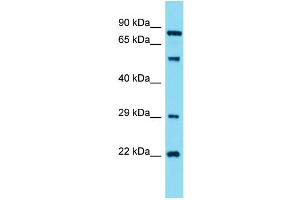 Western Blotting (WB) image for anti-Guanylate Cyclase 1, Soluble, alpha 2 (GUCY1A2) (N-Term) antibody (ABIN2791570)