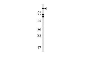 Western blot analysis of anti-ULK2 Antibody (N-term) (ABIN392692 and ABIN2842178) in K562 cell line lysates (35 μg/lane). (ULK2 Antikörper  (N-Term))