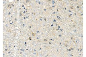 ABIN6257219 and ABIN6276016 at 1/100 staining Rat brain tissue by IHC-P. (GPR153 Antikörper  (Internal Region))