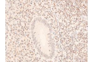 Immunohistochemistry (IHC) image for anti-Janus Kinase 1 (JAK1) (pTyr1022), (pTyr1023) antibody (ABIN6255762)