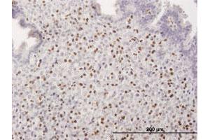 Immunohistochemistry (Formalin-fixed Paraffin-embedded Sections) (IHC (fp)) image for anti-Runt-Related Transcription Factor 3 (RUNX3) (AA 1-429) antibody (ABIN514065)