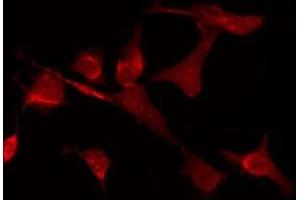 ABIN6275139 staining LOVO by IF/ICC. (GABRD Antikörper  (Internal Region))