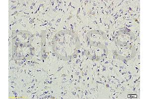 Formalin-fixed and paraffin embedded rat small intestine tissue labeled with Rabbit Anti-gremlin Polyclonal Antibody (ABIN687082) at 1:200 followed by conjugation to the secondary antibody and DAB staining.