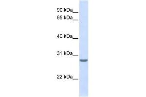 Tetraspanin 6 antibody used at 1 ug/ml to detect target protein.
