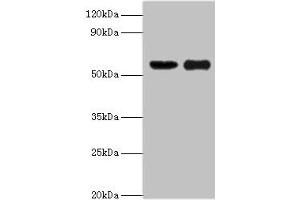 Western blot All lanes: OXCT1 antibody at 8 μg/mL Lane 1: Mouse heart tissue Lane 2: Mouse kidney tissue Secondary Goat polyclonal to rabbit IgG at 1/10000 dilution Predicted band size: 57, 14 kDa Observed band size: 57 kDa (OXCT1 Antikörper  (AA 261-520))